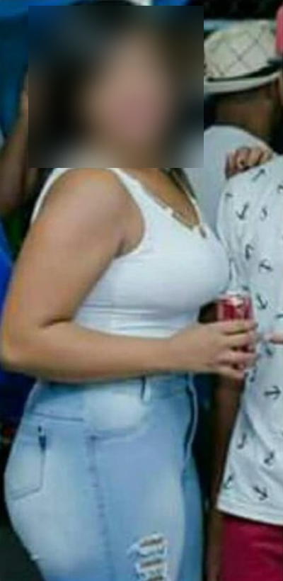Antes — Fernanda L.