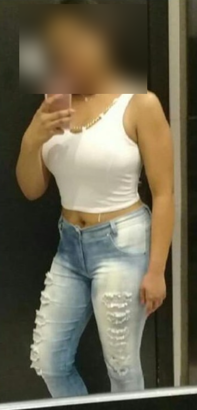 Depois — Fernanda L.