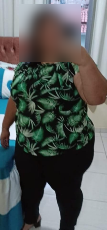 Antes — Patrícia M.