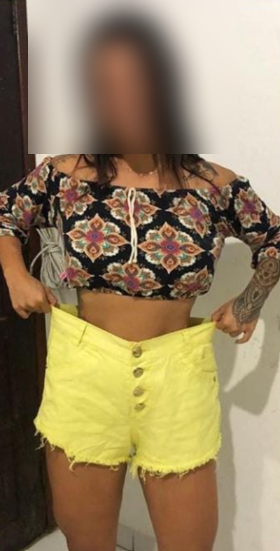 Depois — Juliana T.